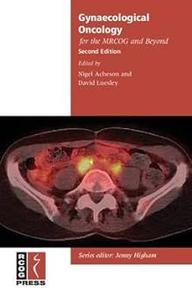 Gynaecological Oncology for the MRCOG and Beyond  Ed 2