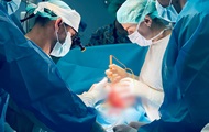 Во Львове прооперировали троих детей с врожденными полукилограммовыми опухолями