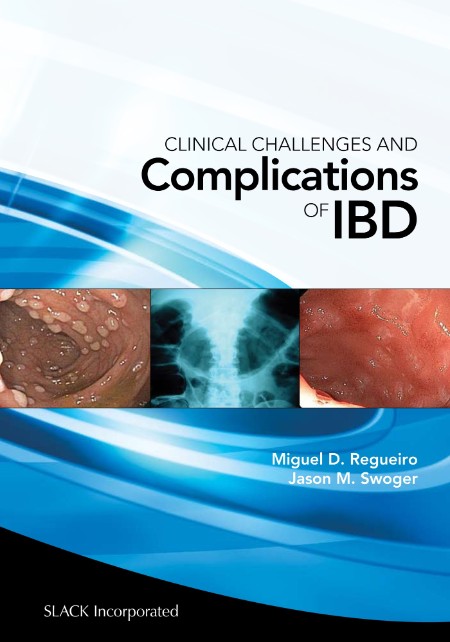 Clinical Challenges and Complications of IBD by Miguel Regueiro