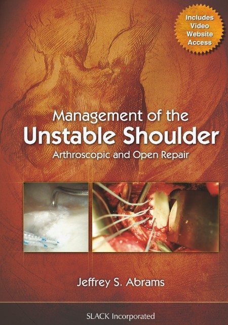 Management of the Unstable Shoulder by Jeffrey Abrams F2e4685a6c8ed69bc4b6e8b6e258d14f