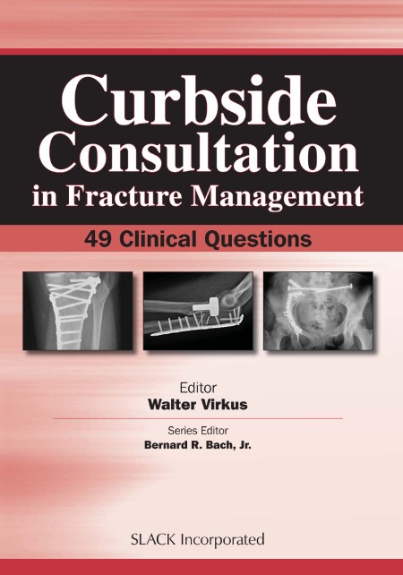 Curbside Consultation in Fracture Management by Walter Virkus