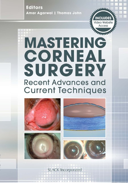 Mastering Corneal Surgery by Amar Agarwal