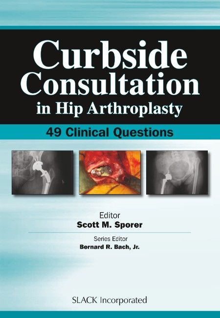 Curbside Consultation in Hip Arthroplasty by Scott Sporer