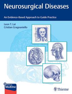 Neurosurgical Diseases An Evidence–Based Approach to Guide Practice
