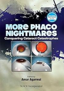 More Phaco Nightmares Conquering Cataract Catastrophes