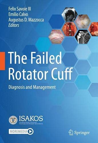 The Failed Rotator Cuff Diagnosis and Management (2024)