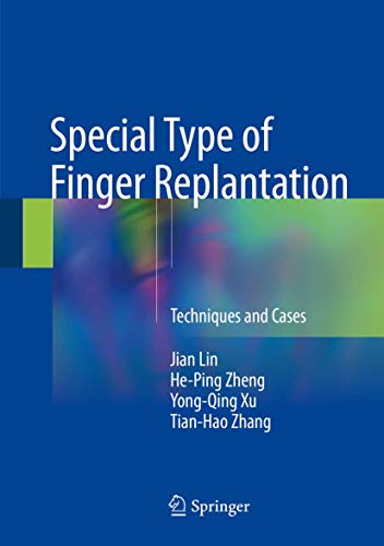 Special Type of Finger Replantation Techniques and Cases (2024)