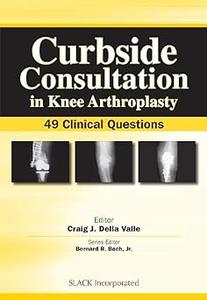 Curbside Consultation in Knee Arthroplasty 49 Clinical Questions