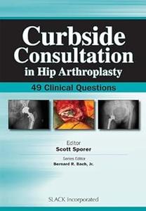 Curbside Consultation in Hip Arthroplasty 49 Clinical Questions