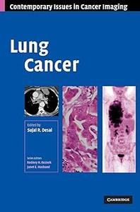 Lung Cancer