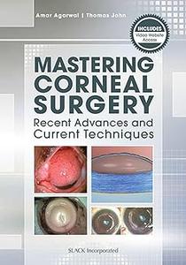 Mastering Corneal Surgery Recent Advances and Current Techniques