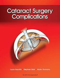 Cataract Surgery Complications