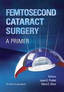 Femtosecond Cataract Surgery A Primer