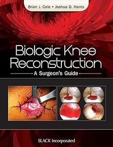 Biologic Knee Reconstruction A Surgeon's Guide