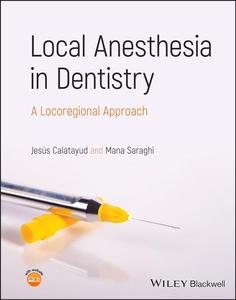Local Anesthesia in Dentistry A Locoregional Approach