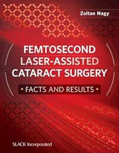 Femtosecond Laser–Assisted Cataract Surgery Facts and Results