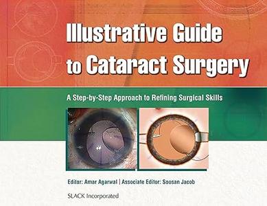 Illustrative Guide to Cataract Surgery A Step–by–Step Approach to Refining Surgical Skills