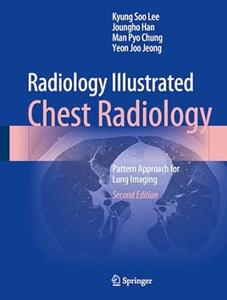 Radiology Illustrated Chest Radiology (2nd Edition)