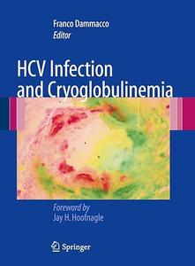 HCV Infection and Cryoglobulinemia (2024)