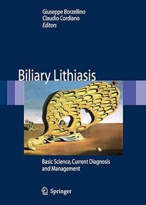 Biliary Lithiasis Basic Science, Current Diagnosis and Management (2024)