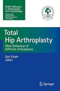 Total Hip Arthroplasty Wear Behaviour of Different Articulations (2024)