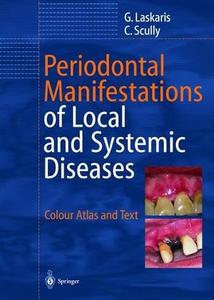 Periodontal Manifestations of Local and Systemic Diseases Colour Atlas and Text
