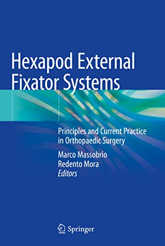 Hexapod External Fixator Systems Principles and Current Practice in Orthopaedic Surgery (2024)