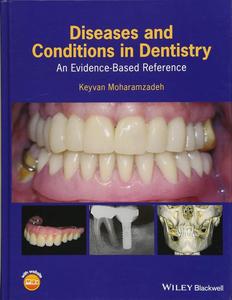 Diseases and Conditions in Dentistry An Evidence–Based Reference