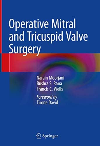 Operative Mitral and Tricuspid Valve Surgery (2024)
