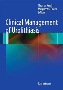 Clinical Management of Urolithiasis (2024)