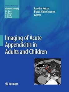 Imaging of Acute Appendicitis in Adults and Children (2024)