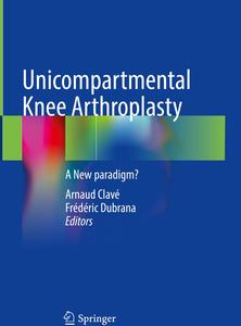 Unicompartmental Knee Arthroplasty A New Paradigm