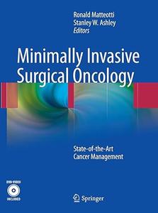 Minimally Invasive Surgical Oncology State–of– the–Art Cancer Management