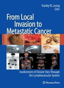 From Local Invasion to Metastatic Cancer Involvement of Distant Sites Through the Lymphovascular System (Repost)