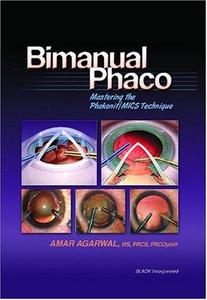 Bimanual Phaco Mastering the PhakonitMICS Technique