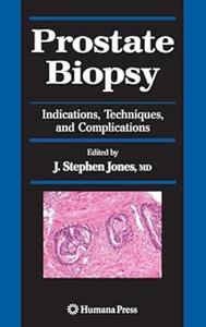 Prostate Biopsy Indications, Techniques, and Complications (Repost)
