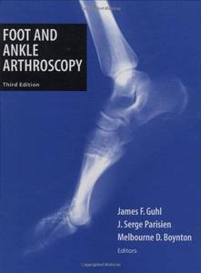 Foot and Ankle Arthroscopy (2024)