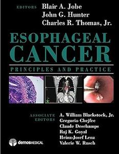 Esophageal Cancer Principles and Practice