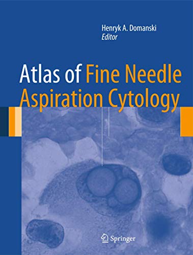 Atlas of Fine Needle Aspiration Cytology (2014)