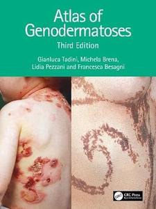 Atlas of Genodermatoses (3rd Edition)