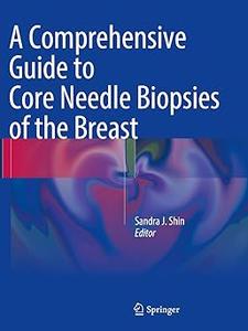 A Comprehensive Guide to Core Needle Biopsies of the Breast (2024)