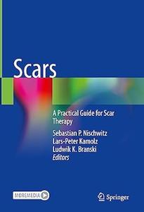 Scars A Practical Guide for Scar Therapy