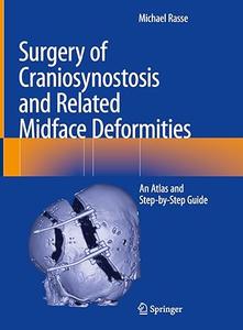 Surgery of Craniosynostosis and Related Midface Deformities