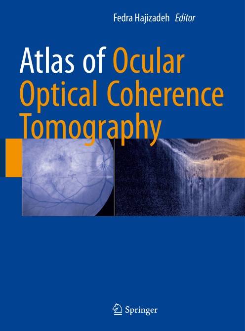 Atlas of Ocular Optical Coherence Tomography (2024)