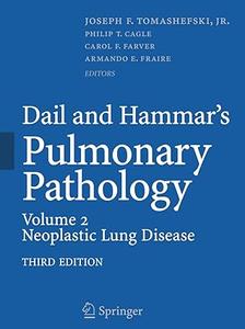 Dail and Hammar's Pulmonary Pathology Volume II Neoplastic Lung Disease