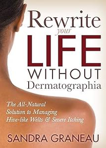 Rewrite Your Life Without Dermatographia The All-Natural Solution to Managing Hive-like Welts and Severe Itching