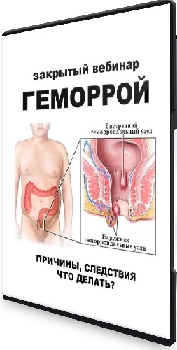 Геморрой (pravda.pro.pisheprom) (2024) Вебинар