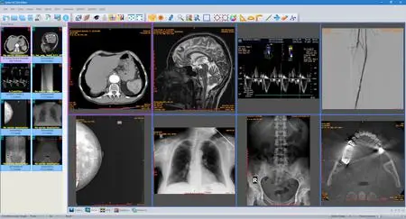 Sante DICOM Editor 10.0.9