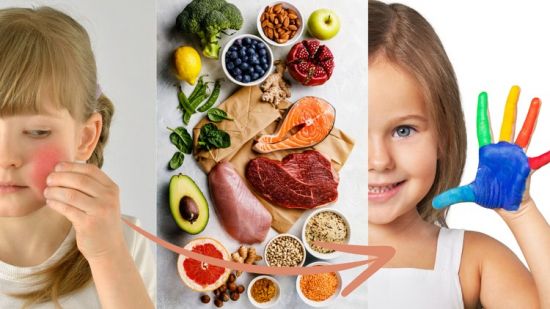 Manage eczema, healthy eating for kids.