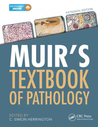 Muir's Textbook of Pathology - C Simon Herrington (Editor)